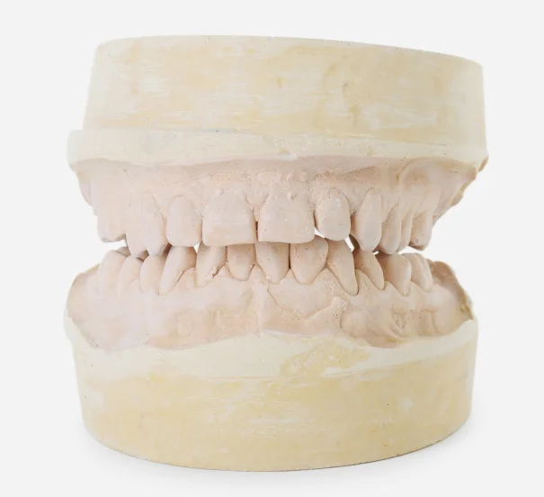 Perguntas frequentes sobre Ortodontia- Dra Andreia Guimaraes Implantodontia Ortodontia